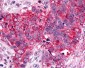CXCR6 Antibody (Cytoplasmic Domain)